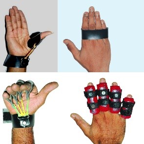 Splints